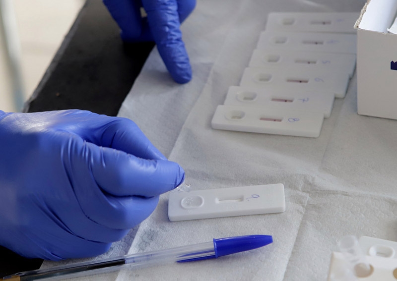 Δωρεάν rapid covid tests για τις επιχειρήσεις του Δήμου Λυκόβρυσης- Πεύκης από Επαγγελματικό Επιμελητήριο, Περιφέρεια και Ιατρικό Σύλλογο