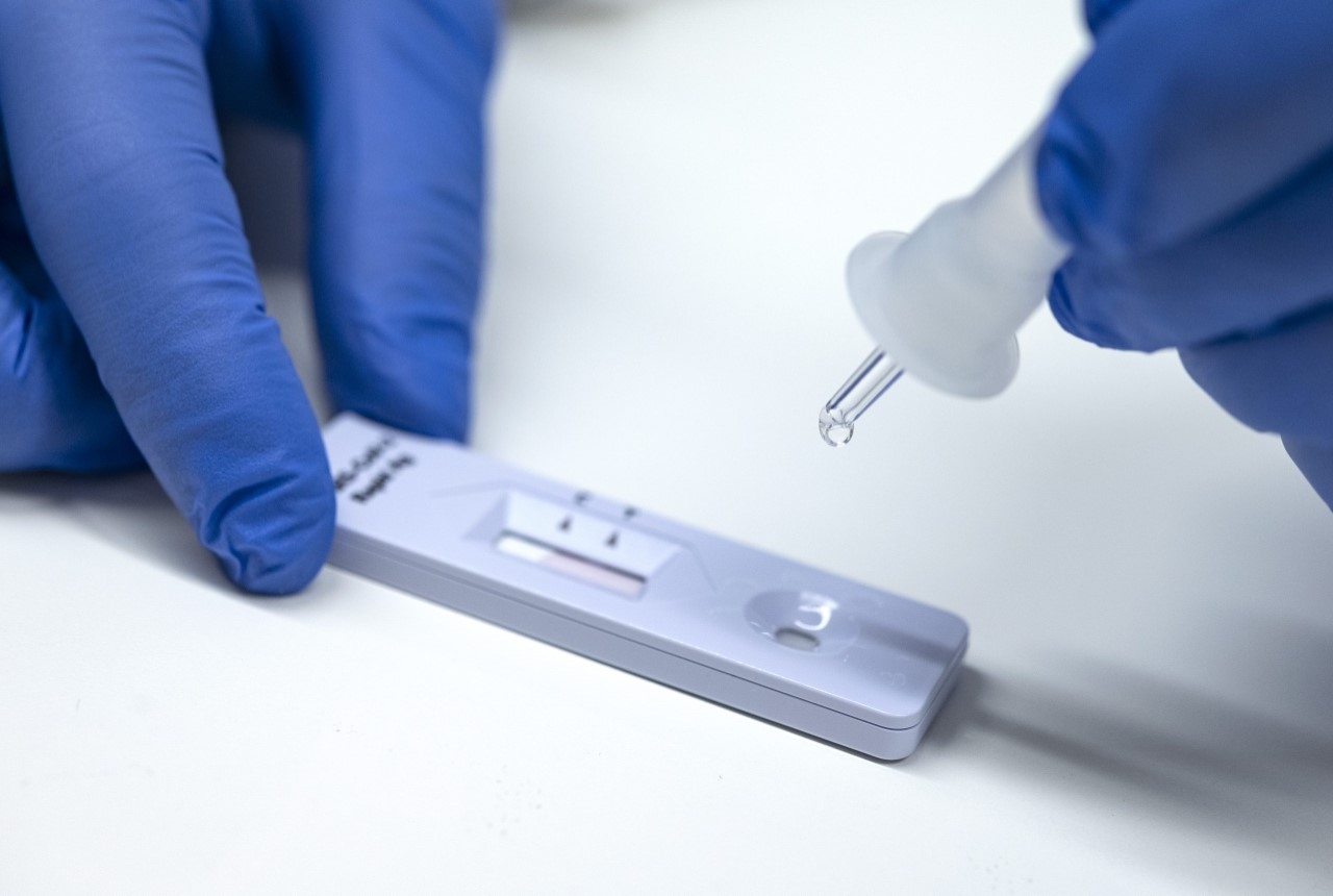 Δωρεάν rapid tests στο Πνευματικό Κέντρο Λυκόβρυσης την Τετάρτη 17/01